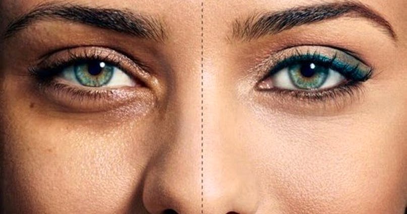 Come coprire le occhiaie: il correttore ed altri trucchi