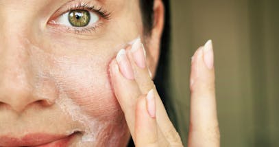 Acido salicilico: tutte le proprietà per la pelle