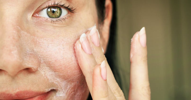 Acido salicilico: tutte le proprietà per la pelle