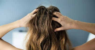 Prurito cuoio capelluto: cause, rimedi e consigli