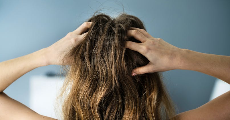 Prurito cuoio capelluto: cause, rimedi e consigli