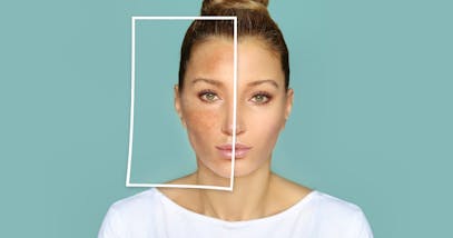 Macchie sulla pelle del viso: cause e rimedi